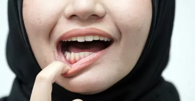 Bahaya Terlalu Banyak Menelan Fluoride Pada Pasta Gigi