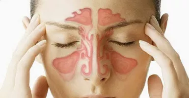 Cara Mengobati Sinus dengan Semprot Hidung hingga Antibiotik