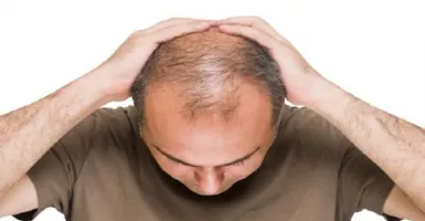 Hindari Rambut Botak, Pakai 5 Bahan Alami Ini