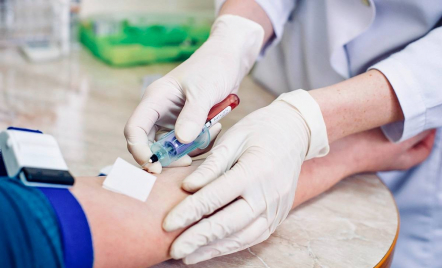 3 Tes Darah yang Perlu Dilakukan Rutin Setiap Tahun - GenPI.co