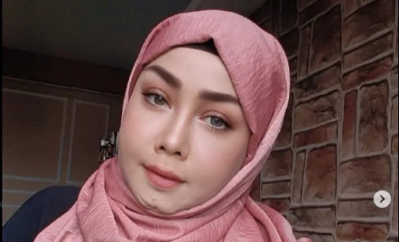 Wajah Bikin Minder, Rency Milano Habiskan Rp 800 Juta demi Operasi Plastik - GenPI.co