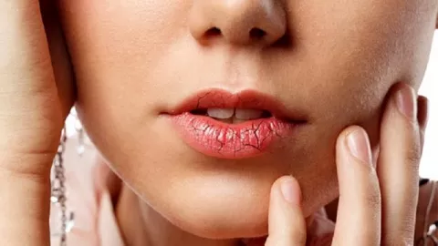 Bahaya! Bibir Pecah-Pecah Berpengaruh pada Kondisi Kesehatan - GenPI.co