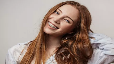 Wajib Tahu! Cara Mencegah Karang Gigi Bagi Pengguna Behel - GenPI.co