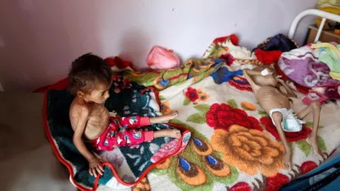 Gawat, Perang Yaman Buat 16 Juta Orang Bisa Mati Kelaparan - GenPI.co