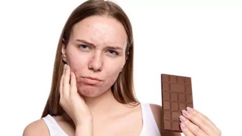 3 Penyebab Timbul Jerawat di Wajah, Nomor 2 Banyak Makan Cokelat - GenPI.co