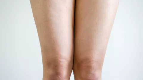 Cerahkan Lutut Hitam dengan 4 Bahan Alami - GenPI.co