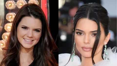 Dulu Polos, Lihat Perubahan Wajah Kendall Jenner Setelah Oplas - GenPI.co