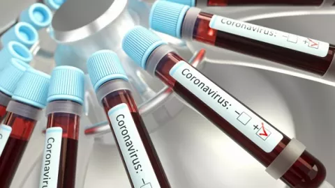 Israel Top Banget, Bisa Melacak Keberadaan Virus Corona - GenPI.co
