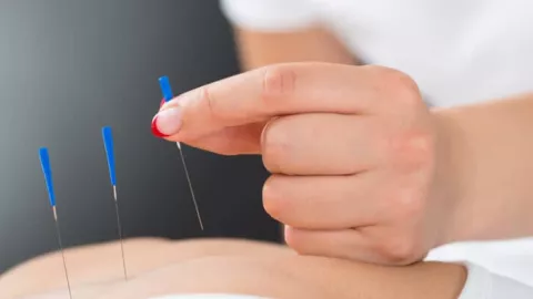 Menjajal Kehebatan Akupunktur untuk Menurunkan Berat Badan - GenPI.co