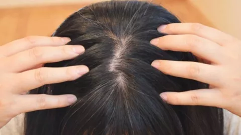 3 Penyebab Rambut Lepek yang Perlu Diketahui Wanita - GenPI.co