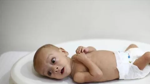 3 Langkah Perbaikan Gizi untuk Bayi Stunting, Catat Moms! - GenPI.co