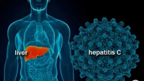 Soal Hepatitis Akut, Langkah Pemerintah Sudah Tepat - GenPI.co