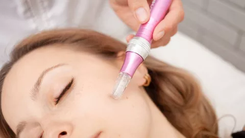 Mengupas Manfaat Microneedling, Langkah Cerdas Menuju Kulit Lebih Mulus - GenPI.co