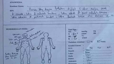 Anak 13 Tahun Digigit 5 Anjing Liar di Lombok, Alami Luka di Kaki hingga Badan - GenPI.co