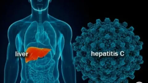 Usai Covid-19 Ada Virus Hepatitis Misterius, Kata Kadiskes Bali? - GenPI.co BALI