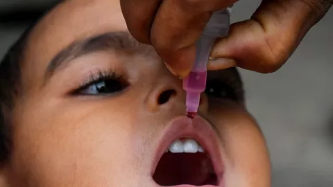 Dinkes: 10 Anak di Tangerang Terinfeksi Campak Rubella pada 2022 - GenPI.co BANTEN