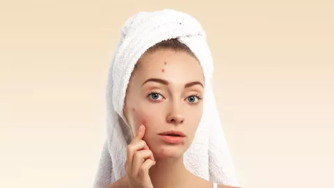 Tips Jitu Menghilangkan Jerawat dengan 5 Bahan Alami - GenPI.co