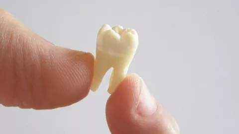 Ikuti 5 Cara ini Agar Gigi Kuning Kamu Kembali Putih - GenPI.co JABAR