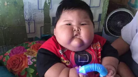 Balita Obesitas di Bekasi Jalani Terapi Penurunan Berat Badan - GenPI.co JABAR