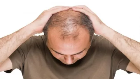 Hindari Rambut Botak, Pakai 5 Bahan Alami Ini - GenPI.co