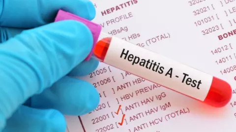 Jadi KLB di Pacitan, Begini Tanda Terkena Penyakit Hepatitis A - GenPI.co