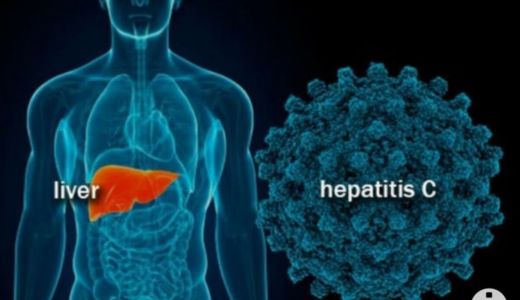 Dinkes Bogor Minta Warga Waspadai 4 Gejala Hepatitis Akut - GenPI.co JABAR