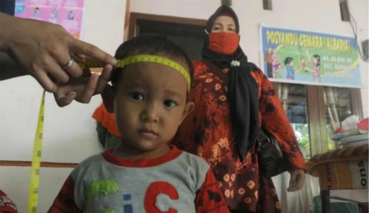 Anak Lahir Cebol, Penjabat Wali Kota Kendari Minta OPD Serius - GenPI.co SULTRA