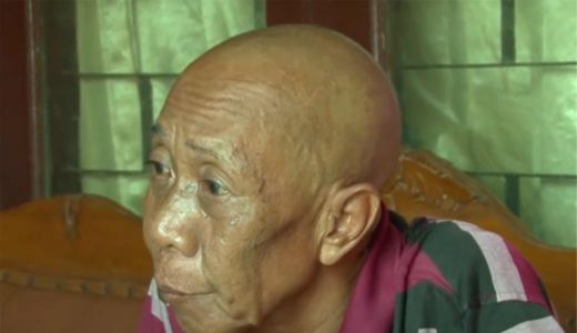 Pak Ogah Cepek Dulu Dong Dilarikan ke Rumah Sakit, Mohon Doanya - GenPI.co SULTRA