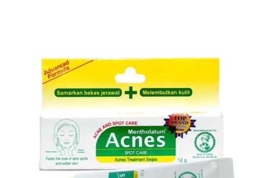 Hanya Rp30 Ribu, Acnes Spot Care Ampuh Atasi Bekas Jerawat - GenPI.co