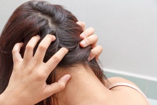 Rambut Bebas Ketombe dengan Sari Cuka Apel, Begini Cara Pakainya - GenPI.co