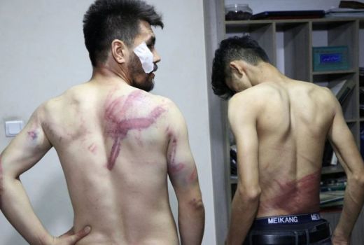 Wajah Asli Taliban Terkuak, Wartawan Babak Belur Dipukuli - GenPI.co