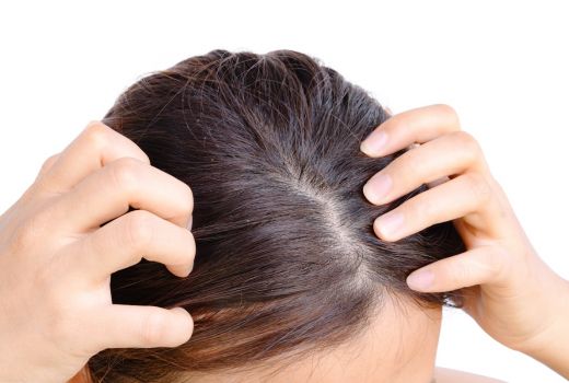 3 Tips Ampuh Menghilangkan Gatal pada Kulit Kepala - GenPI.co