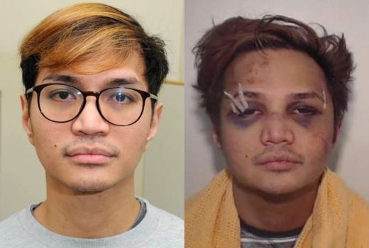Nasib Tragis Reynhard Sinaga, Matanya Lebam Dihajar Korbannya - GenPI.co