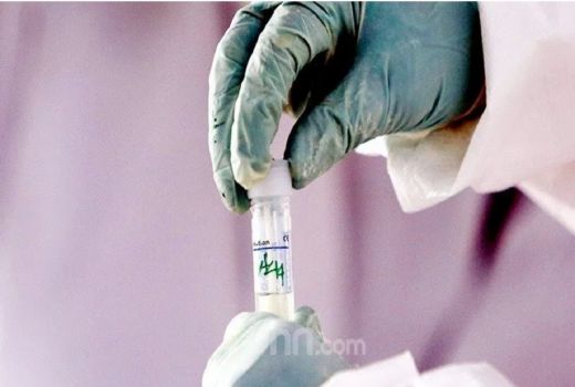 Kendalikan Cacar Monyet, Kemenkes Pesan 2000 Dosis Vaksin Monkeypox - GenPI.co