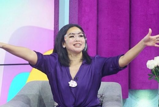 Nama Gala Sky Diubah Doddy Sudrajat, Feni Rose Bongkar Alasannya - GenPI.co