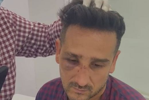 Begini Kronologi Pengeroyokan Claudio Martinez di Bar Jaksel - GenPI.co