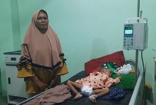 3 Anak Balita Gizi Buruk di Maluku Utara Dirawat di RSUD Ternate - GenPI.co