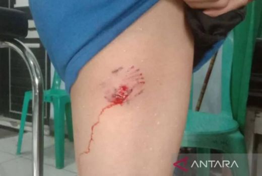 Anak Usia 7 Tahun Meninggal Dunia Setelah Digigit Anjing Rabies di NTT - GenPI.co