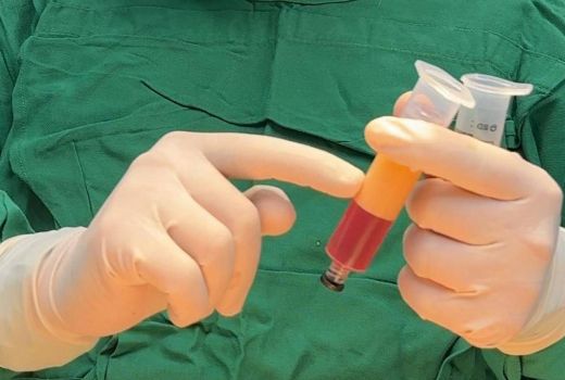 Fat Filler, Inovasi Terbaru dr. Ayu Widyaningrum dengan Teknologi Jerman - GenPI.co
