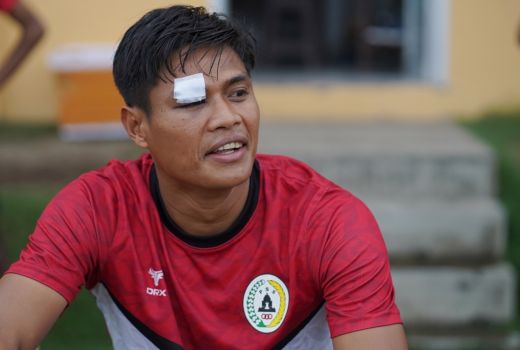 Bek PSS Sleman Fachruddin Alami Robek di Kelopak Mata - GenPI.co