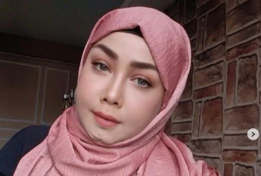 Wajah Bikin Minder, Rency Milano Habiskan Rp 800 Juta demi Operasi Plastik - GenPI.co