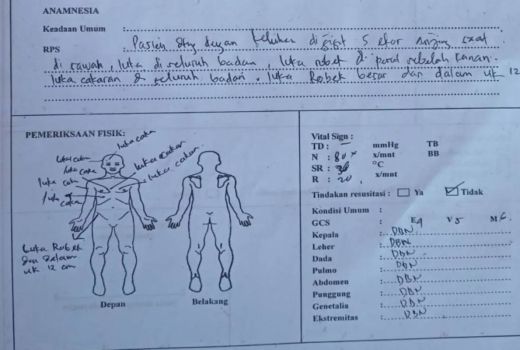 Anak 13 Tahun Digigit 5 Anjing Liar di Lombok, Alami Luka di Kaki hingga Badan - GenPI.co