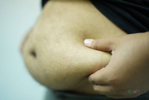 Alpukat Ampuh Menurunkan Kolesterol bagi Penderita Obesitas - GenPI.co