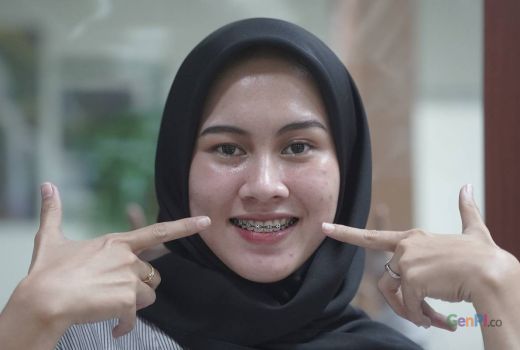 Benarkah Memasang Behel atau Kawat Gigi Dilarang Islam? Begini Penjelasan Buya Yahya - GenPI.co