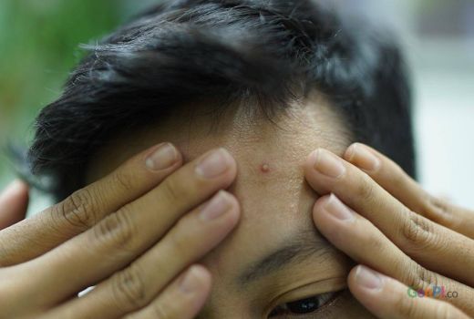 Tips Menjaga Kesehatan Kulit, Bisa dengan Perawatan Teratur - GenPI.co