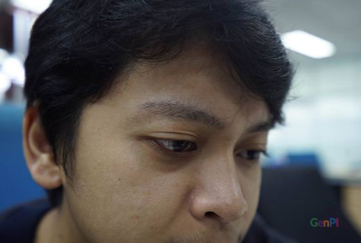 Tips Mencegah Rambut Rontok, Konsumsi Makanan Bernutrisi - GenPI.co