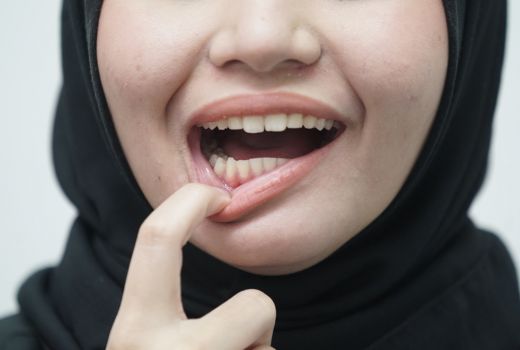 Musuh Pertama Kegagalan Kencan Bukan Penampilan, tapi Nafas Bau - GenPI.co BALI