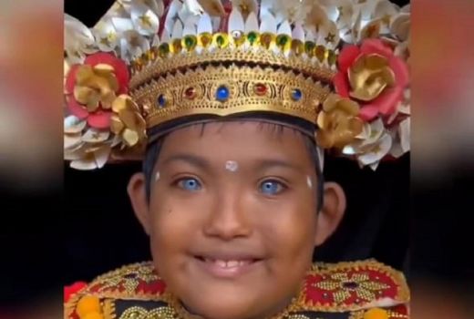 Bali Viral! Geger Bocah Buleleng Bermata Biru, Kata Dokter? - GenPI.co BALI