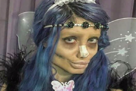 Usai Operasi Plastik, Selebgram Iran Terjerat Kasus Penistaan - GenPI.co