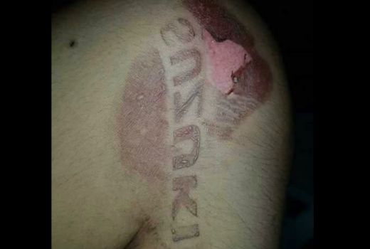 Viral Lucu, Kaki Ketimpa Mesin Motor, Sakitnya Malah Bikin Malu - GenPI.co